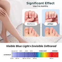 Advanced Nail Fungus Treatment & Repair Device – Home Solution for Fingernails & Toenails - AxenBox