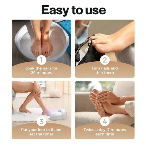 Fortschrittliches Gerät zur Behandlung und Reparatur von Nagelpilz – Lösung für zu Hause für Finger- und Zehennägel 