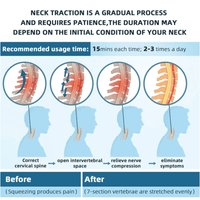 Cilious Gen - 2 Neck Traction Collar - AxenBox